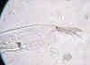 alonopsiselongatabag.jpg (40592 byte)