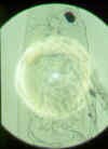 daphniacucullatafilterapp.jpg (30401 byte)