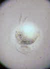holopedium.jpg (15593 byte)